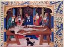 La dissection, d'après le Livre des propriétés des choses. France, XVe siècle. Paris, BnF