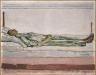 Ferdinand Hodler, Valentine sur son lit de mort, 1915. Huile sur toile, 65 x 81 cm. Bâle, Kunstmuseum, dépôt Rudolf-Staechelin (c) Kunstmuseum, Basel / Photo: Martin Bühler
